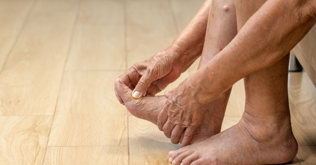 Image of an elderly woman massaging her foot due to swelling