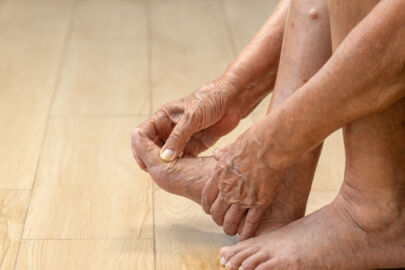 image of an elderly woman massaging her foot due to swelling